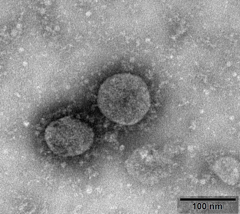 タイでも猛威を振るっている新型コロナウイルスの顕微鏡写真